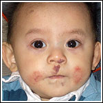 Heilbaby
