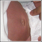 Bellybutton