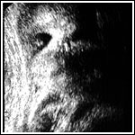 Ultrasound1