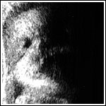 Ultrasound2